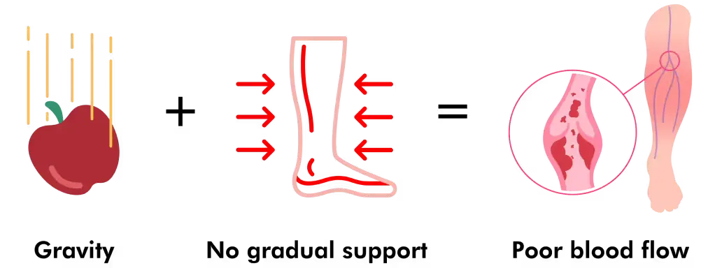 Gravity plus no gradual support equals poor blood flow